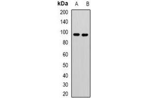 Western blot analysis of KANSL3 expression in Jurkat (A), U251 (B) whole cell lysates. (KANSL3 抗体)