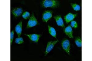 IF analysis of MTMR2 using anti-MTMR2 antibody (ABIN7603228).