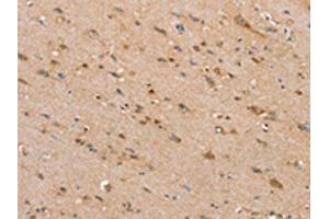 Immunohistochemistry (IHC) image for anti-Solute Carrier Family 25 (Mitochondrial Carrier, Ornithine Transporter) Member 2 (SLC25A2) antibody (ABIN7192440)