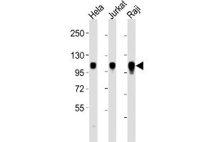 All lanes : Anti-ITGA7 Antibody (C-term) at 1:2000 dilution Lane 1: Hela whole cell lysates Lane 2: Jurkat whole cell lysates Lane 3: Raji whole cell lysates Lysates/proteins at 20 μg per lane. (ITGA7 抗体  (C-Term))
