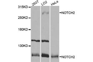 Western blot analysis of extracts of various cell lines, using NOTCH2 antibody. (NOTCH2 抗体)