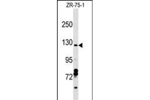 CCD Antibody (C-term) (ABIN1537645 and ABIN2849114) western blot analysis in ZR-75-1 cell line lysates (35 μg/lane). (Syndetin/VPS50 抗体  (C-Term))