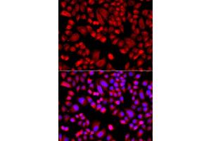 Immunofluorescence (IF) image for anti-Actin Related Protein 2/3 Complex, Subunit 3, 21kDa (ARPC3) (AA 1-178) antibody (ABIN6137129)