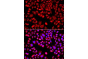Immunofluorescence analysis of  cells using  antibody (ABIN6129197, ABIN6137129, ABIN6137130 and ABIN6223718). (ARPC3 抗体  (AA 1-178))