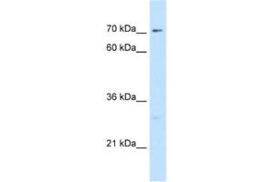Western Blotting (WB) image for anti-CTP Synthase (CTPS) antibody (ABIN2462930)