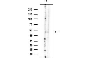 anti-Small ArfGAP2 (SMAP2) antibody
