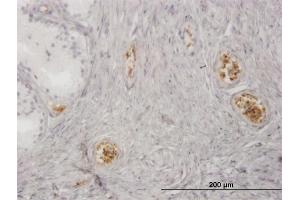 Immunoperoxidase of monoclonal antibody to HBZ on formalin-fixed paraffin-embedded human prostate. (HBZ 抗体  (AA 1-81))