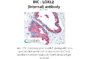 Image no. 2 for anti-Lysyl Oxidase-Like 2 (LOXL2) (Internal Region) antibody (ABIN1736515) (LOXL2 抗体  (Internal Region))