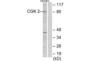 Western blot analysis of extracts from HUVEC cells, using CGK 2 antibody. (PRKG2 抗体  (Internal Region))