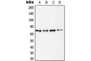 Western blot analysis of S6K1 expression in MCF7 (A), HEK293 (B), MDCK (C), mouse brain (D) whole cell lysates. (RPS6KB1 抗体  (C-Term))