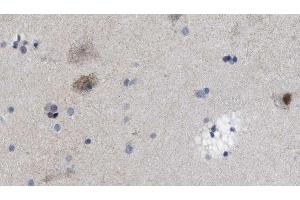 Immunohistochemistry (IHC) image for anti-Ubiquitin Carboxyl-terminal Esterase L1 (Ubiquitin Thiolesterase) (UCHL1) (C-Term) antibody (ABIN6264167)