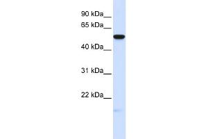 WB Suggested Anti-MFRP Antibody Titration:  0. (MFRP 抗体  (Middle Region))