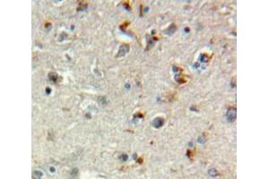 IHC-P analysis of Brain tissue, with DAB staining. (TGFBR3 抗体  (AA 469-724))