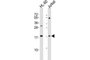 All lanes : Anti-KISS1 Antibody (N-Term) at 1:2000 dilution Lane 1: HL-60 whole cell lysates Lane 2: Jurkat whole cell lysates Lysates/proteins at 20 μg per lane. (KISS1 抗体  (AA 20-52))