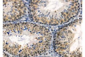 ABIN6260274 and ABIN6272782 at 1/100 staining Mouse testis tissue by IHC-P.