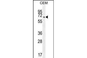 COX10 Antibody (C-term) (ABIN654671 and ABIN2844366) western blot analysis in CEM cell line lysates (35 μg/lane). (COX10 抗体  (C-Term))