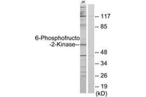 Western blot analysis of extracts from Jurkat cells, using PFKFB2 Antibody. (PFKFB2 抗体  (AA 1-50))