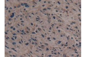 Immunohistochemistry (IHC) image for anti-Glycyl-tRNA Synthetase (GARS) (AA 567-735) antibody (ABIN7435301)