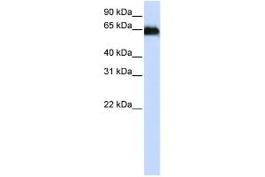 WB Suggested Anti-ADAM12 Antibody Titration:  0.