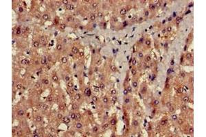 Immunohistochemistry of paraffin-embedded human liver tissue using ABIN7175541 at dilution of 1:100 (PROC 抗体  (AA 288-409))