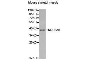 Western Blotting (WB) image for anti-NADH Dehydrogenase (Ubiquinone) 1 alpha Subcomplex, 9, 39kDa (NDUFA9) antibody (ABIN2650936) (NDUFA9 抗体)
