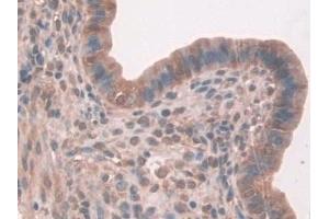 Detection of FAPa in Mouse Uterus Tissue using Polyclonal Antibody to Fibroblast Activation Protein Alpha (FAPa)