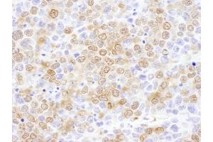 Immunohistochemistry (IHC) image for anti-NUDC (AA 281-331) antibody (ABIN7455044) (NUDC 抗体  (AA 281-331))
