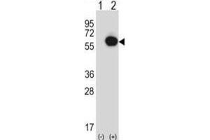 Western Blotting (WB) image for anti-Ran GTPase Activating Protein 1 (RANGAP1) antibody (ABIN2997532) (RANGAP1 抗体)