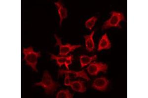 ABIN6266625 staining HepG2 by IF/ICC.