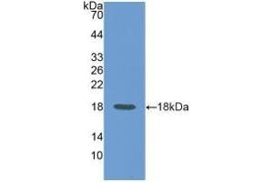 Detection of Recombinant CD99, Rat using Polyclonal Antibody to Cluster Of Differentiation 99 (CD99) (CD99 抗体  (AA 26-160))