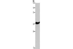 Gel: 8 % SDS-PAGE, Lysate: 40 μg, Lane: Mouse brain tissue, Primary antibody: ABIN7190859(GPR78 Antibody) at dilution 1/200, Secondary antibody: Goat anti rabbit IgG at 1/8000 dilution, Exposure time: 10 minutes (GPR78 抗体)