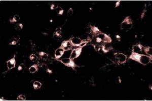 Immunoflourescence of rat neurons.