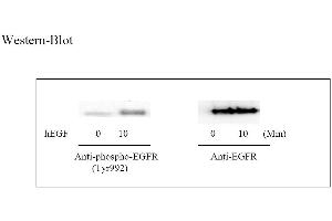 Image no. 3 for Epidermal Growth Factor Receptor (EGFR) ELISA Kit (ABIN625238) (EGFR ELISA 试剂盒)