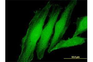 Immunofluorescence of purified MaxPab antibody to EXOSC1 on HeLa cell. (EXOSC1 抗体  (AA 1-195))