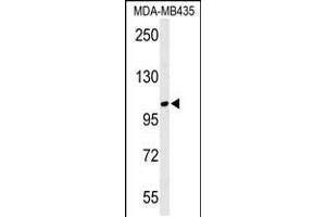 Western blot analysis of LUZP1 Antibody in MDA-MB435 cell line lysates (35ug/lane) (LUZP1 抗体  (C-Term))