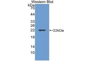Detection of Recombinant GREM1, Rat using Polyclonal Antibody to Gremlin 1 (GREM1) (GREM1 抗体  (AA 25-184))