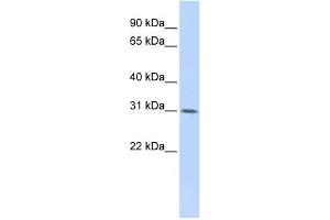WDR33 antibody used at 1 ug/ml to detect target protein. (WDR33 抗体  (Middle Region))