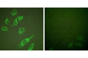 PMA + -Immunofluorescence analysis of HeLa cells, treated with PMA (125ng/ml, 30mins), using 14-3-3 ζ (phospho-Ser58) antibody. (14-3-3 zeta 抗体  (pSer58))