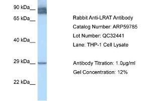 Western Blotting (WB) image for anti-Lecithin Retinol Acyltransferase (Phosphatidylcholine--Retinol O-Acyltransferase) (LRAT) (N-Term) antibody (ABIN2788210) (LRAT 抗体  (N-Term))