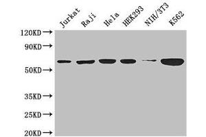 Western Blot Positive WB detected in: Jurkat whole cell lysate, Raji whole cell lysate, Hela whole cell lysate, HEK293 whole cell lysate, NIH/3T3 whole cell lysate, K562 whole cell lysate All lanes: CCT8 antibody at 3 μg/mL Secondary Goat polyclonal to rabbit IgG at 1/50000 dilution Predicted band size: 60, 58, 52 kDa Observed band size: 60 kDa (CCT8 抗体  (AA 224-491))