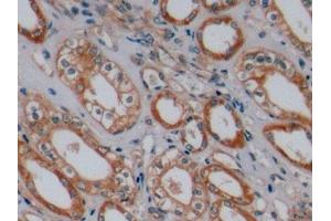 Immunohistochemistry (IHC) image for anti-Mast/stem Cell Growth Factor Receptor (KIT) (AA 321-520) antibody (ABIN7431107)
