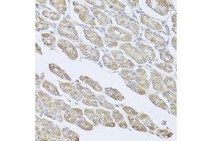 Immunohistochemistry of paraffin-embedded mouse stomach using MSMB antibody at dilution of 1:100 (x40 lens). (MSMB 抗体)