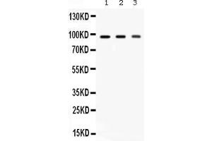 Western blot analysis of Ago2/eIF2C2 expression in rat brain extract ( Lane 1), mouse brain extract ( Lane 2) and HELA whole cell lysates ( Lane 3).