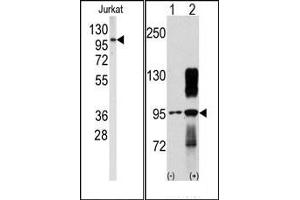 Image no. 1 for anti-Discoidin Domain Receptor tyrosine Kinase 2 (DDR2) antibody (ABIN359957) (DDR2 抗体)