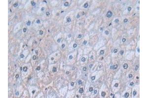 Detection of CD74 in Human Liver Tissue using Polyclonal Antibody to Cluster Of Differentiation 74 (CD74) (CD74 抗体  (AA 78-222))