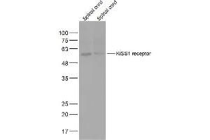 Lane 1: Mouse Spinal cord lysates Lane 2: Rat Spinal cord lysates probed with KiSS1 receptor Polyclonal Antibody, Unconjugated  at 1:2000 dilution and 4˚C overnight incubation. (KISS1R 抗体  (AA 121-200))