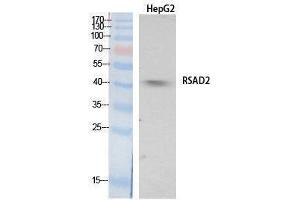 Western Blotting (WB) image for anti-Radical S-Adenosyl Methionine Domain Containing 2 (RSAD2) (Internal Region) antibody (ABIN3178550) (RSAD2 抗体  (Internal Region))