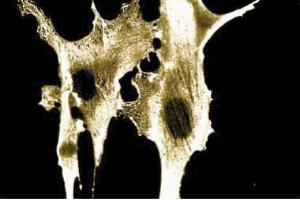 Immunofluorescence staining of human fibroblasts. (Annexin A2 抗体  (AA 123-328))