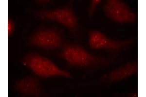 Immunofluorescence staining of methanol-fixed Hela cells using CDK6(phospho-Tyr24) Antibody. (CDK6 抗体  (pTyr24))