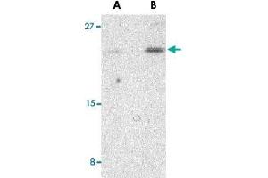Western blot analysis of BIK in Jurkat cell lysate with BIK polyclonal antibody  at (A) 1 and (B) 2 ug/mL . (BIK 抗体  (N-Term))
